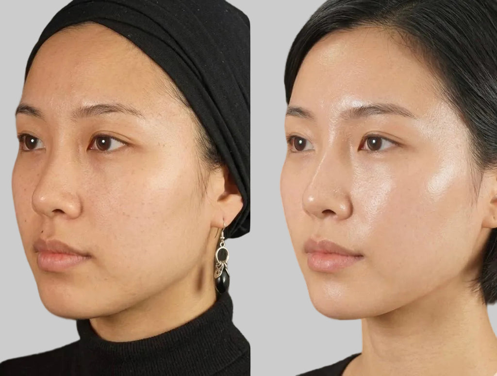 EMS Neck & Face Lifter – Appareil Raffermissant 7 Modes