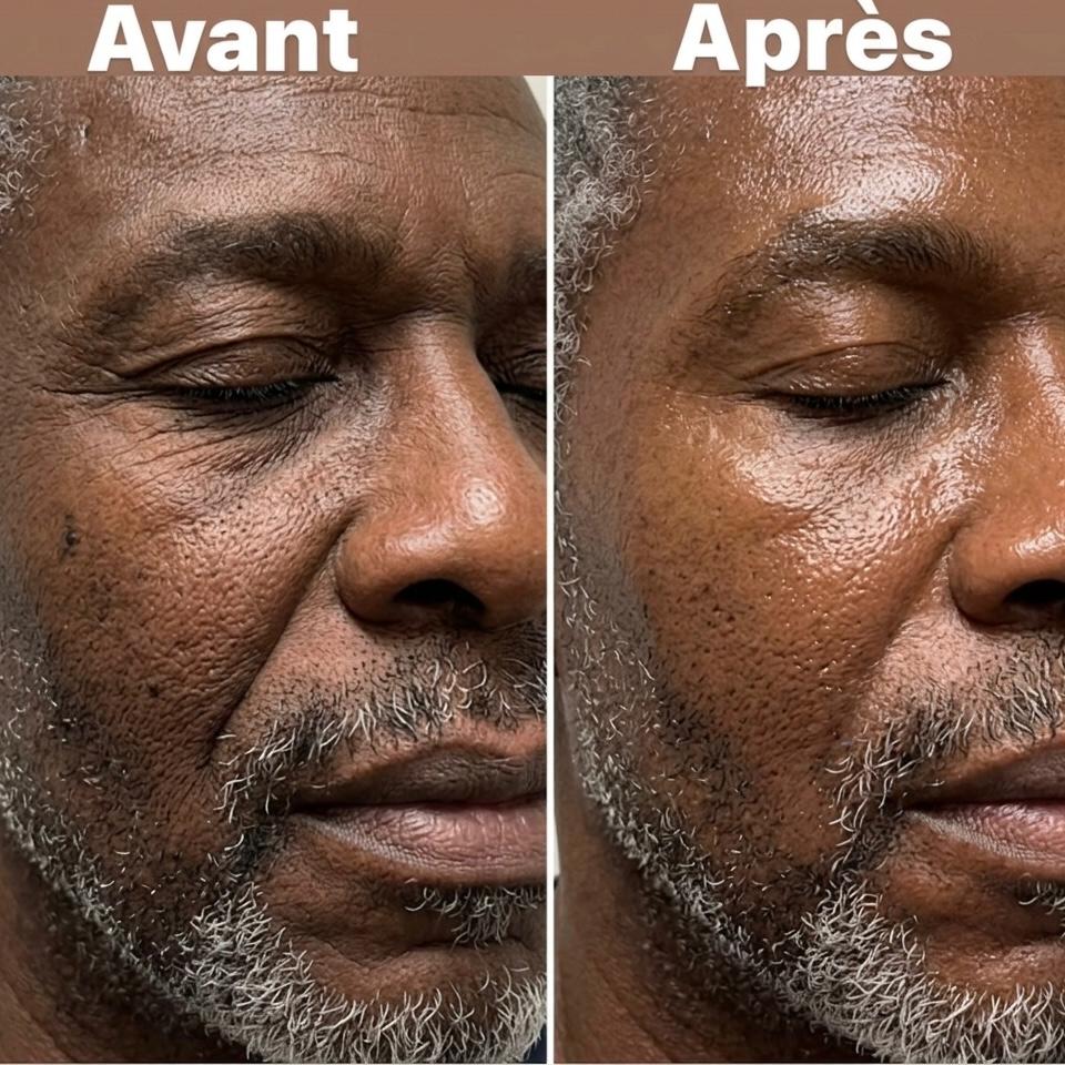 EMS Neck & Face Lifter – Appareil Raffermissant 7 Modes